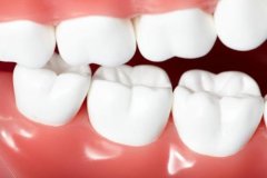 分光测色仪检测牙龈颜色差异